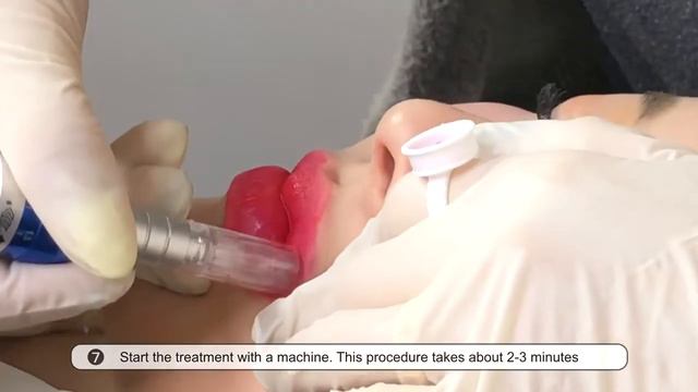 Мезо тонирование губ 👄 Набор из 5ти сывороток-тинтов Cherips🍒 от Stayve