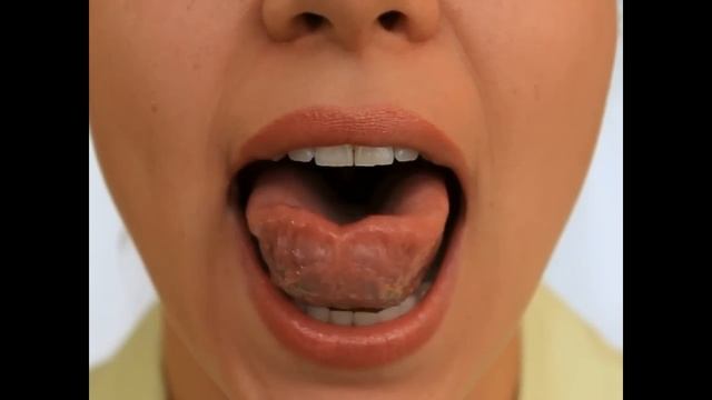 Артикуляционная Гимнастика - Чашка и блюдце 2 смотреть онлайн