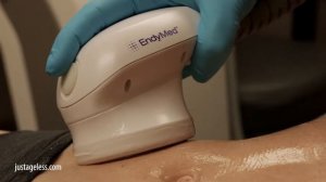 Skin Tightening for your Body with EndyMed at Just Ageless