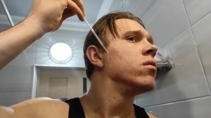 Отростил бороду в 17ЛЕТ за месяц: Мой эксперимент с миноксидилом на 30 дней"