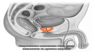 Стимуляция простаты: для чего нужна и как правильно выполняется?