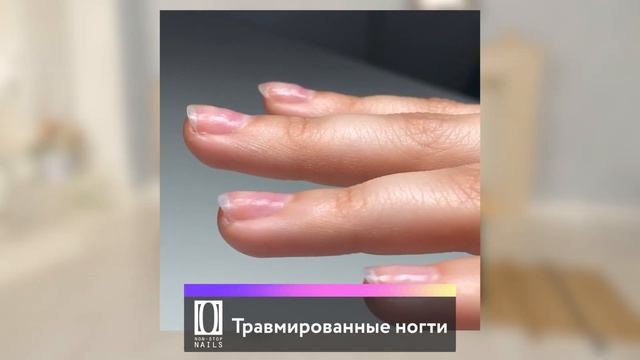 Клиент с проблемными ногтями! Что делать? | Онихолизис, трапециевидная форма ногтей, ногти трамплин смотреть онлайн