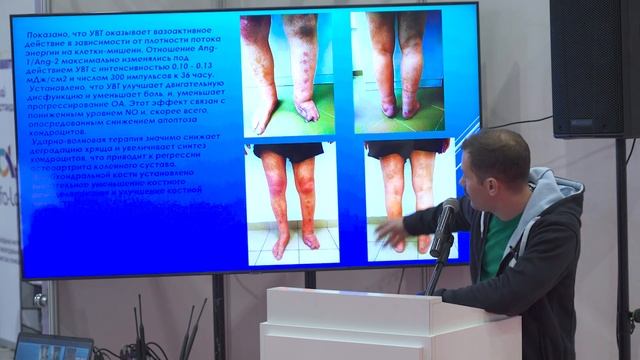Мастер-класс по УВТ и лазеротерапии в лечении и реабилитации заболеваний ОДА. смотреть онлайн