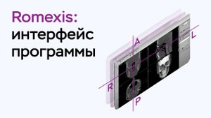 Возможности программы Romexis Viewer: интерфейс программы