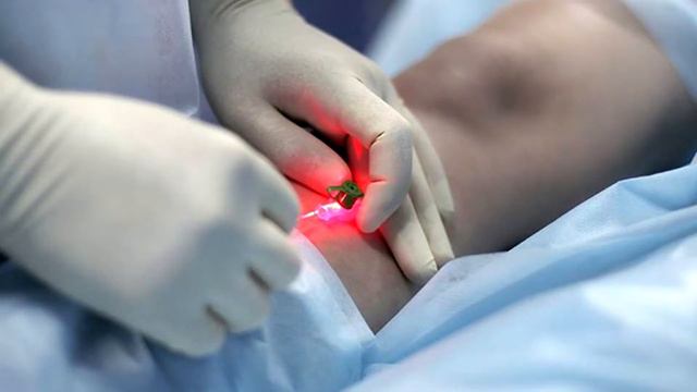 Кто такой флеболог. Аспекты лечения варикоза. Флеболог Мазынский Д.В смотреть онлайн