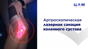 Артроскопическая лазерная санация коленного сустава