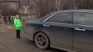 Вырываем молочный зуб машиной