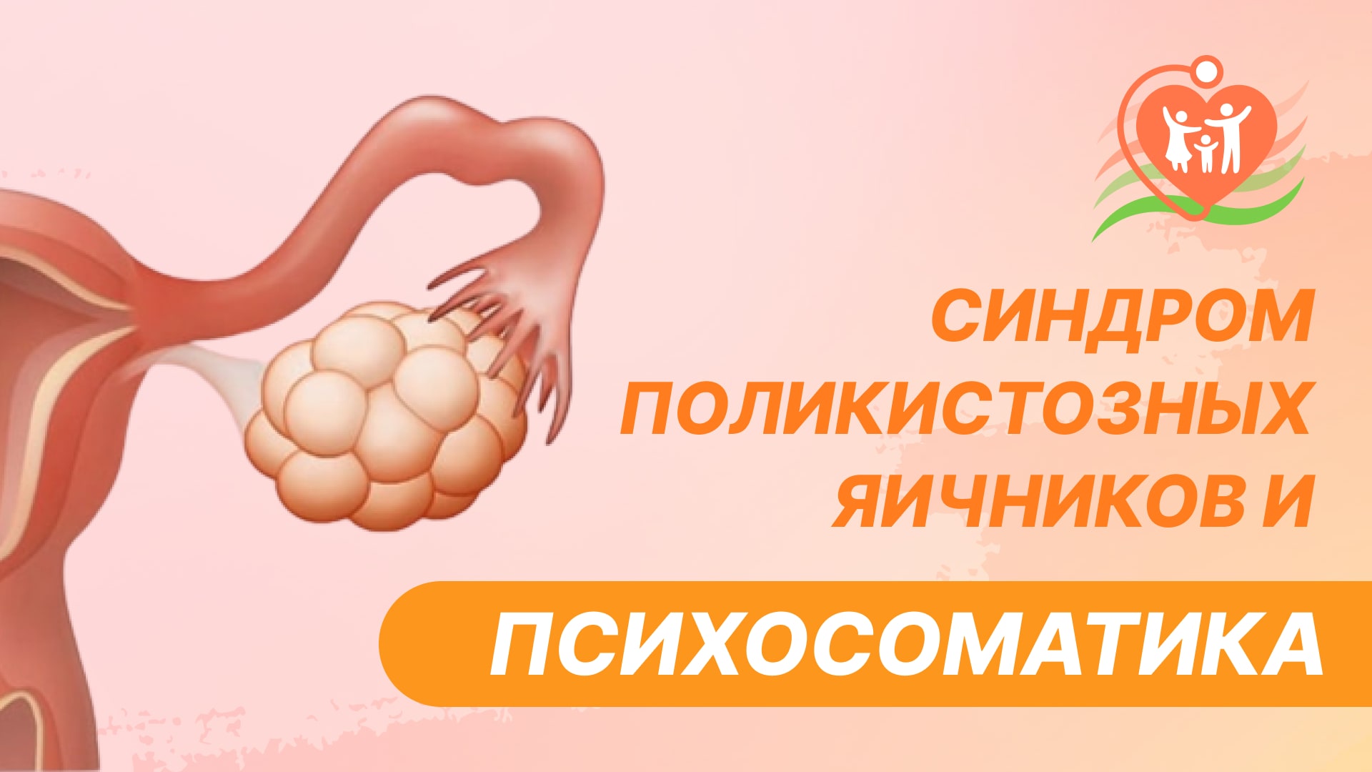 ? Синдром поликистозных яичников и психосоматика