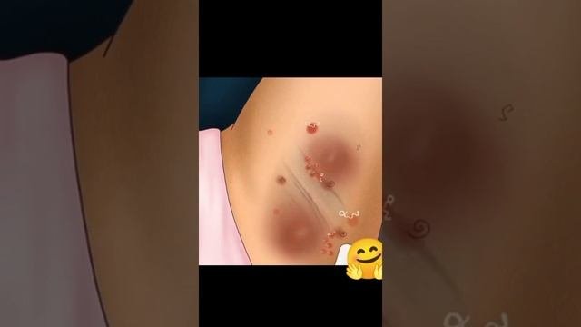 НОВОЕ ВИДЕО!ЧИСТКА ПОДМЫШЕК