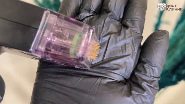 На сегодняшний день Morpheus 8 - это самая мощная RF - технология для омоложения. смотреть онлайн