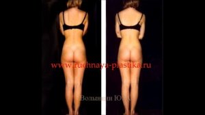 КАК ОТЛИЧИТЬ РУЧНУЮ ПЛАСТИКУ ОТ ПЛАГИАТА?