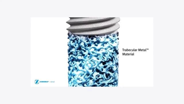 Трабекулярные импланты - их свойства и преимущества (д.м.н. Фурцев Т.В., стом.клиника "МедиДент") смотреть онлайн