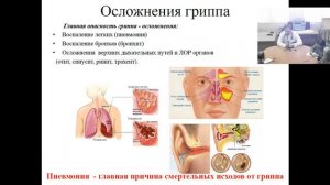 Профилактика гриппа ОРВИ