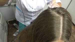 #Красноярск Пробую холодную плазму. Процедура для лица и волос  ? LIVE 230