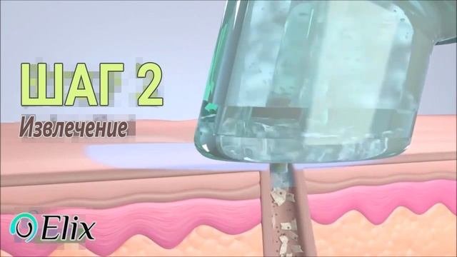 Гидропилинг HydraPeel Plus в Новосибирске