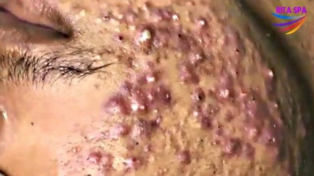 yeu em смотреть онлайн