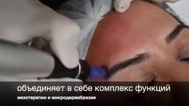 Dermapen дермапен