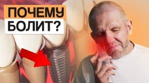 ЗУБНЫЕ ИМПЛАНТЫ МОГУТ БОЛЕТЬ? ПРИЧИНЫ И СПОСОБЫ УСТРАНЕНИЯ БОЛИ