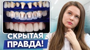 Не ставь виниры, пока не узнаешь ЭТО! О чем умалчивают стоматологи...