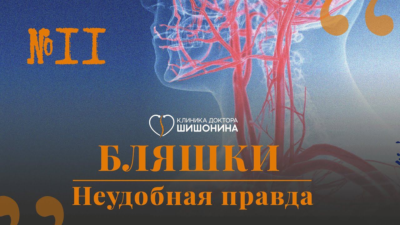 Бляшки и как с ними жить: рассказывает сосудистый хирург в новом выпуске «Хорошей медицины»