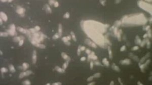 Питание и пищеварение у гидры