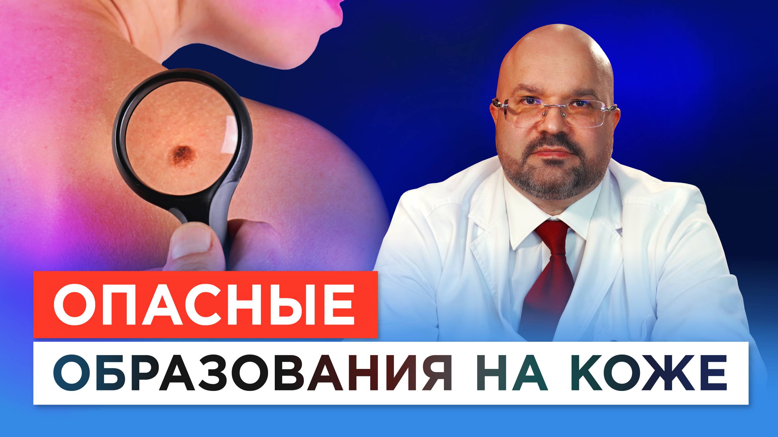 Какие родинки перерастают в рак? Главный дерматолог Минздрава о новообразованиях на коже и меланоме