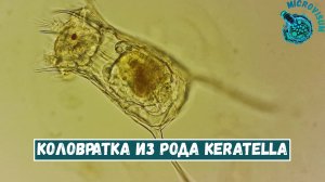 Прекрасная коловратка из рода Keratella