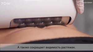Аппаратный массаж Эндосфера для похудения и для лечения целлюлита