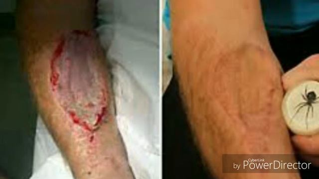 Что будет если вас укусит чёрная вдова? смотреть онлайн