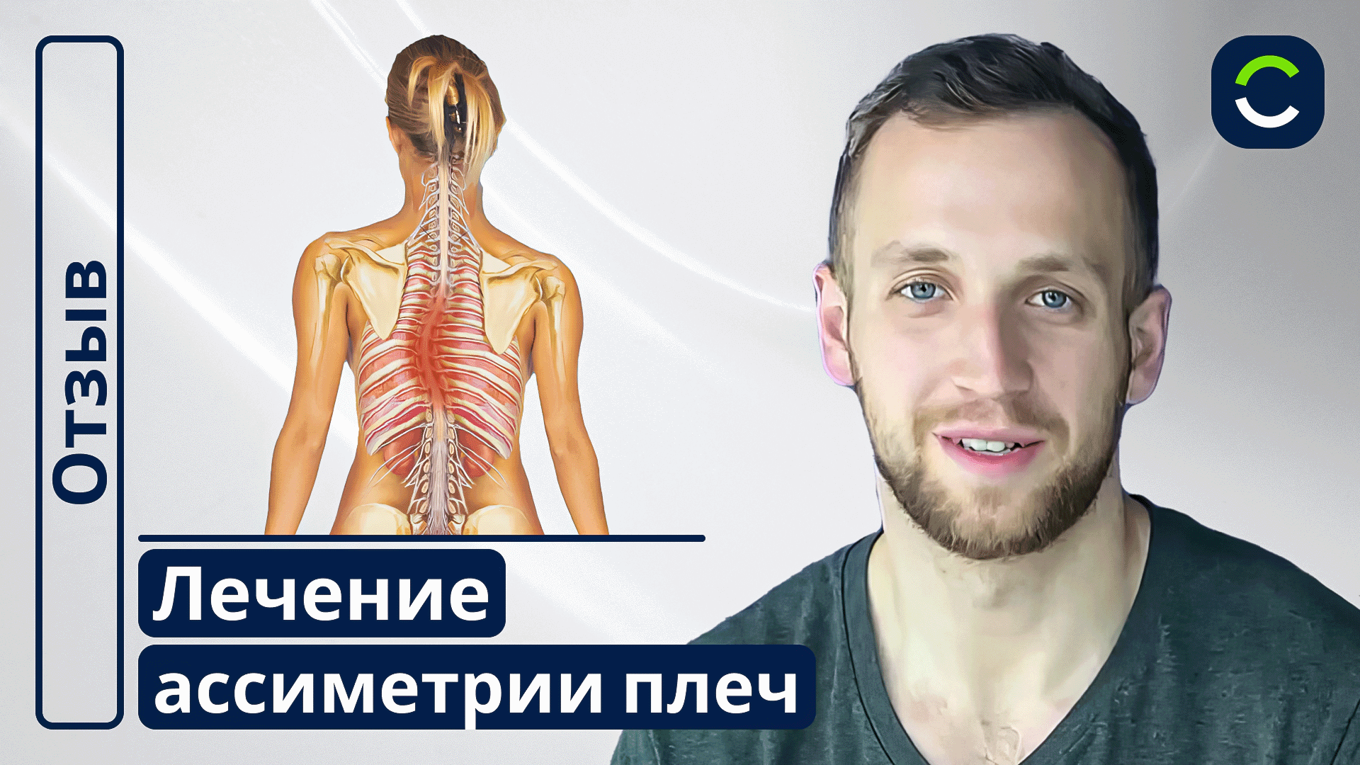 Лечение Ассиметрии Плеч | Отзывы Наших Пациентов