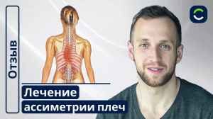 Лечение Ассиметрии Плеч | Отзывы Наших Пациентов