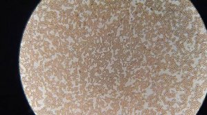 Влияние ШАМПУНЕЙ на кровь человека