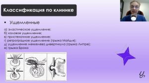 Общая хирургия | Грыжи живота