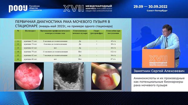 Аминокислоты и их производные как потенциальные биомаркеры рака мочевого пузыря. Замятнин С. А. смотреть онлайн