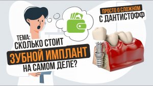 Сколько стоит зубной имплант? → Просто о сложном с Дантистофф #имплантациязубов