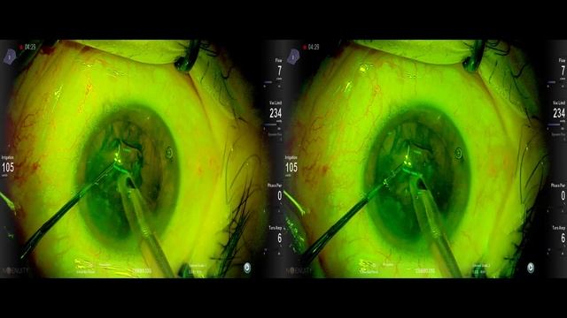 Lukan Mishev live stream смотреть онлайн