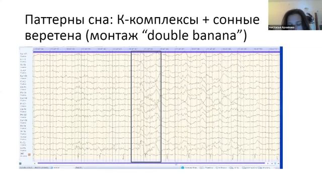 Электроэнцефалография: основные биофизические и технологические аспекты для использования в клинике