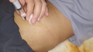 инъекция в ягодичную мышцу