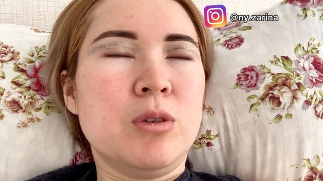 БЛЕФАРОПЛАСТИКА / моя история/ мой опыт/ блефаропластика азиатских век/ Ny.zarina