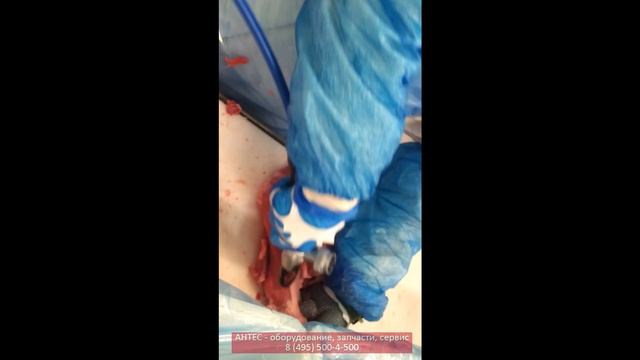 Триммер жилы 2 - FREUND - АНТЕС смотреть онлайн