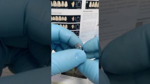 Металлическая коронка