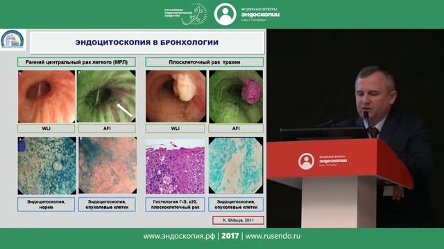 Взгляд в будущее: эндомикроскопическое и эндоцитоскопическое исследование слизистой оболочки бронхо смотреть онлайн
