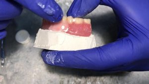 Как починить сломанный протез. Repair of denture