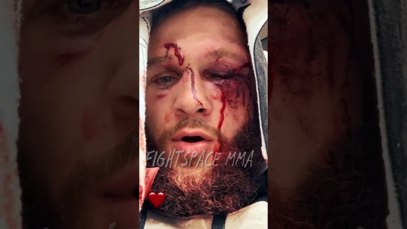 Реакция Рафаэля Физиева сразу после боя / Гейджи-Физиев | FightSpaceММА