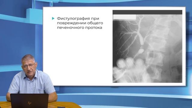 15:30 27.11.2022 Хирургия повреждений внепеченочных желчных путей. Часть 2 смотреть онлайн