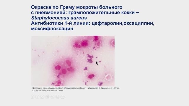 Внебольничная пневмония