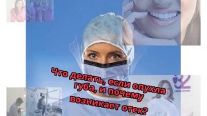 Что делать, если опухла губа, и почему возникает отек?