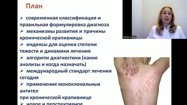 ХРОНИЧЕСКАЯ КРАПИВНИЦА