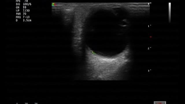 УЗИ Орбит 22 11 2013 10 04 смотреть онлайн