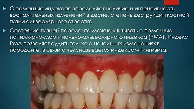 Методы обследования больных с патологией тканей пародонта смотреть онлайн